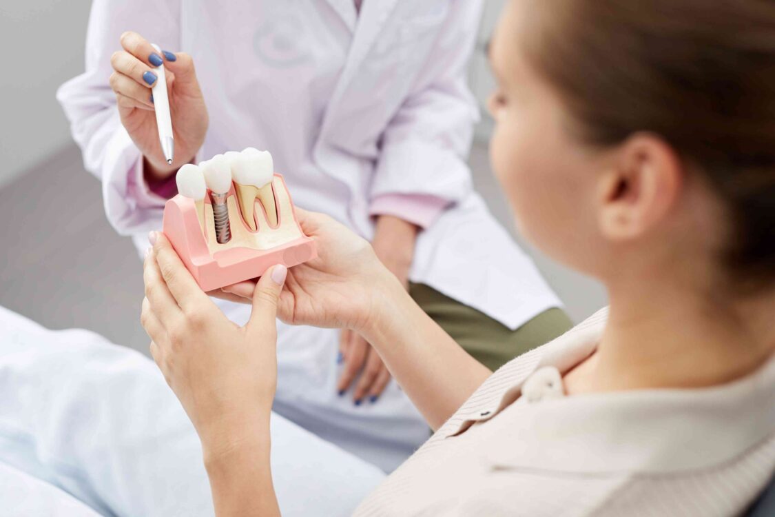 Dental implants: Bridges, Crowns, Implants – Which Is Best?